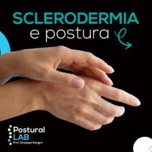 giornata mondiale sclerodermia — Oggi,29giugno,si celebra la Giornata Mondiale della Sclerodermia. La sclerodermia è una malattia